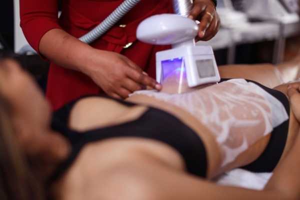 Get Your Dream Body with Non-Invasive Fat Freezing Windsor