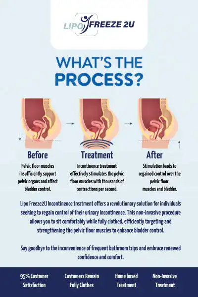 Diagram of how incontinence treatment Windsor works.