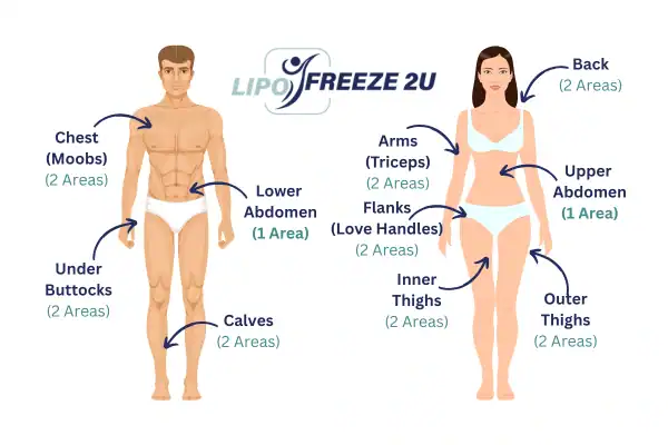 Areas you can have fat freezing treatment Windsor