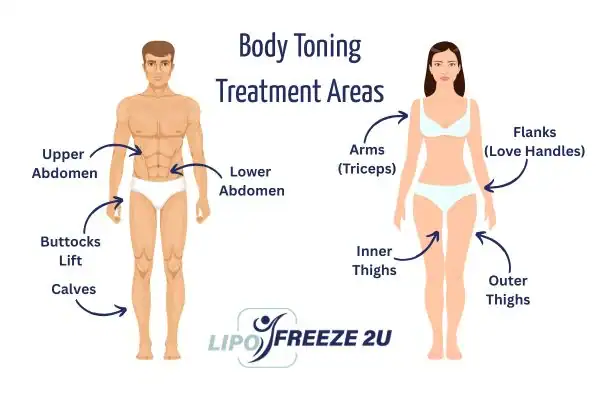 Graphic showing where you can have Body toning Treatment Windsor on your body