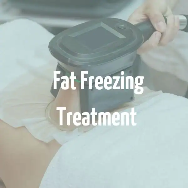 fat freezing treatment Windsor