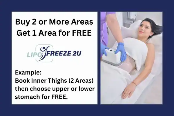 fat freezing prices Windsor