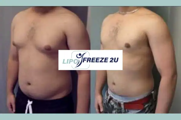 How Long Does It Take to See Results Windsor?