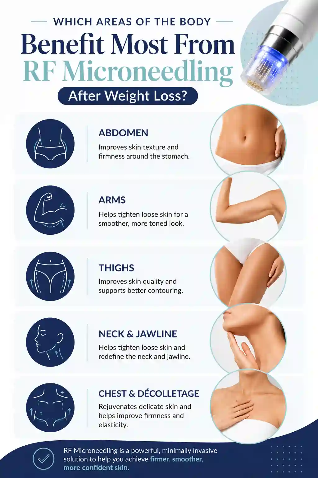 Which Areas of the Body Benefit Most From RF Microneedling After Weight Loss Windsor